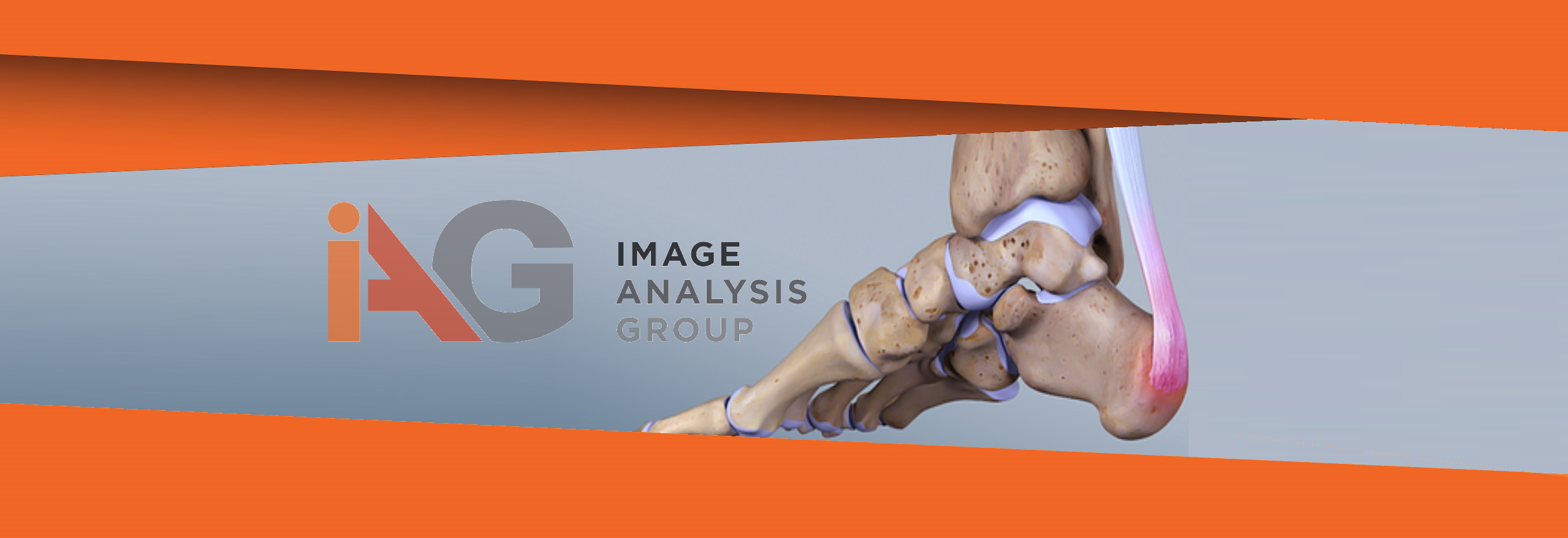 tendon-IAG
