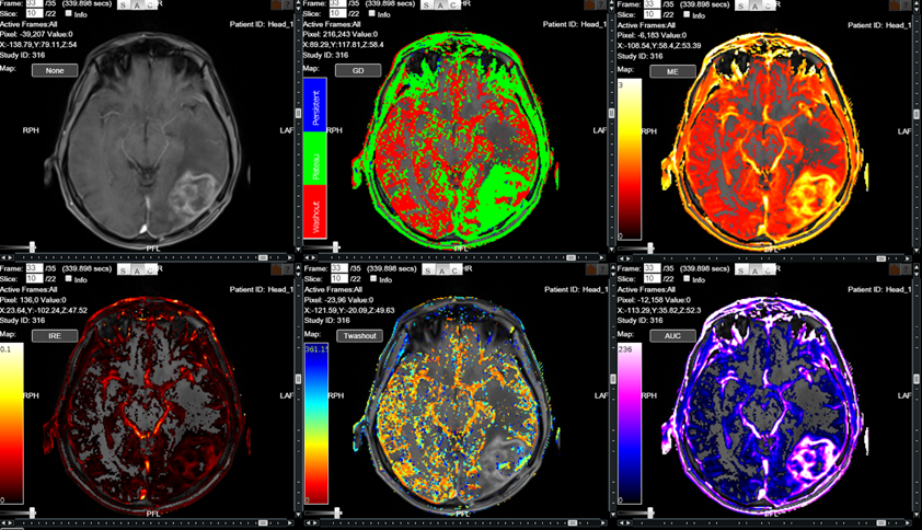 IAG  Strategic Imaging for Accelerated Drug Development