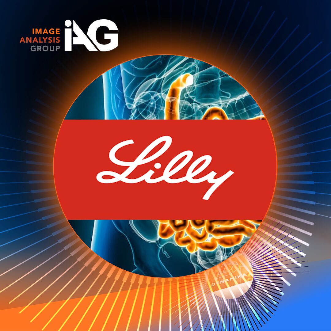 Eli Lilly and Image Analysis Group partnership illustration for AI‑enabled MRI imaging in IBD clinical trials.