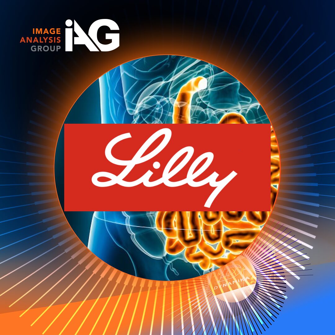 Eli Lilly and Image Analysis Group partnership illustration for AI‑enabled MRI imaging in IBD clinical trials.