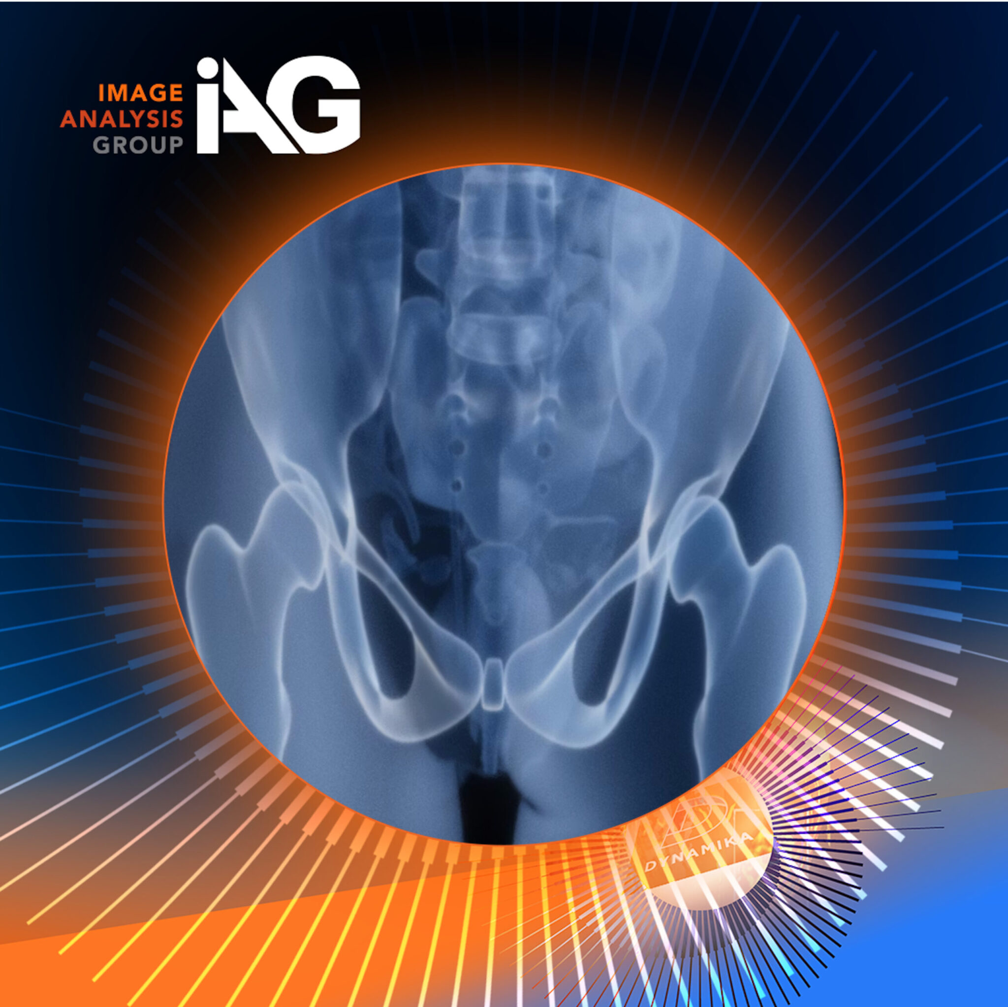 IAG partners with WHO–ESCEO–IOF PRECCO on osteoporosis and bone health research using advanced imaging.