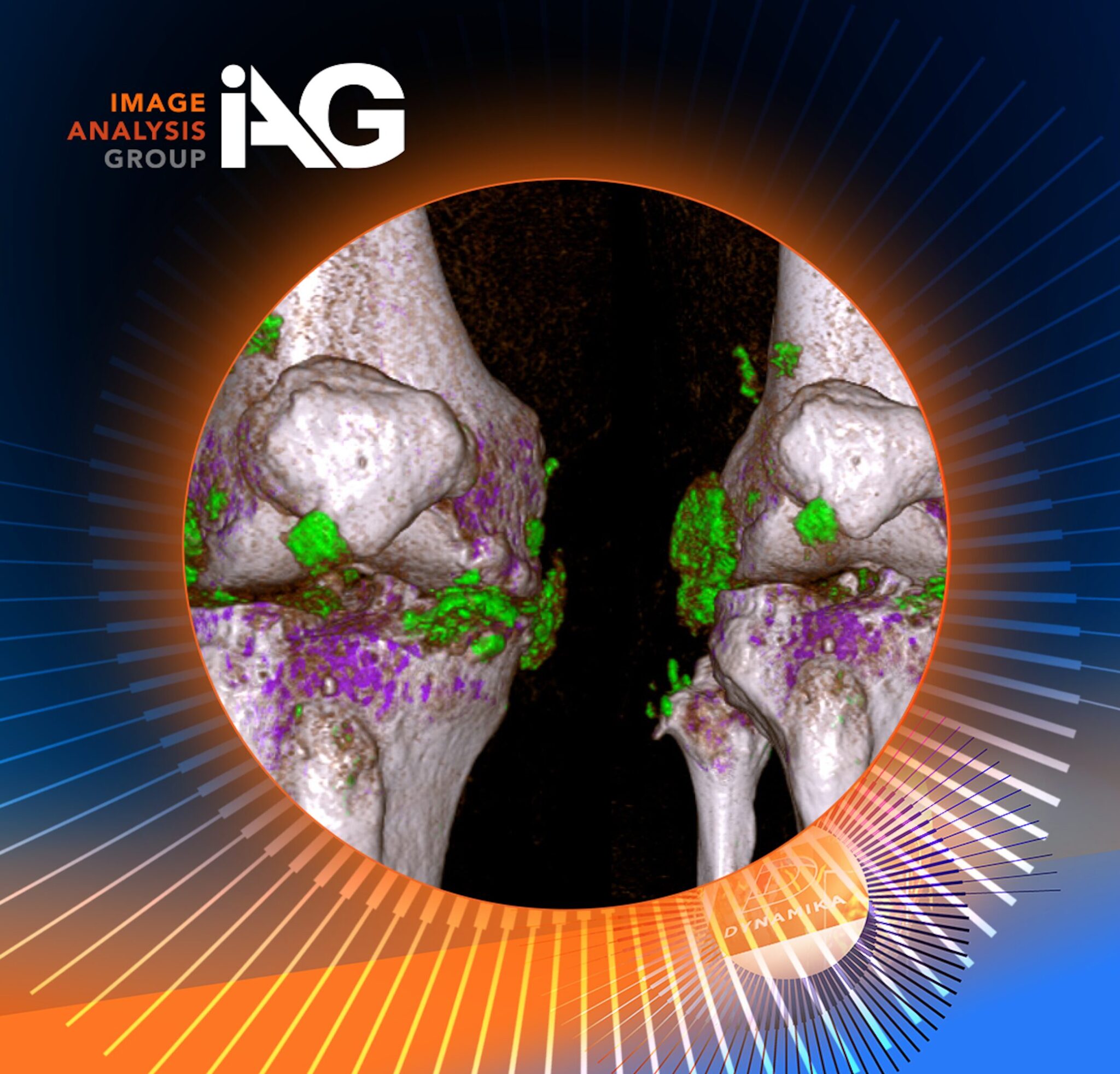 Advancing Bone Health Research: How IAG Helped Redefine Imaging-Based Assessment of Bone Integrity