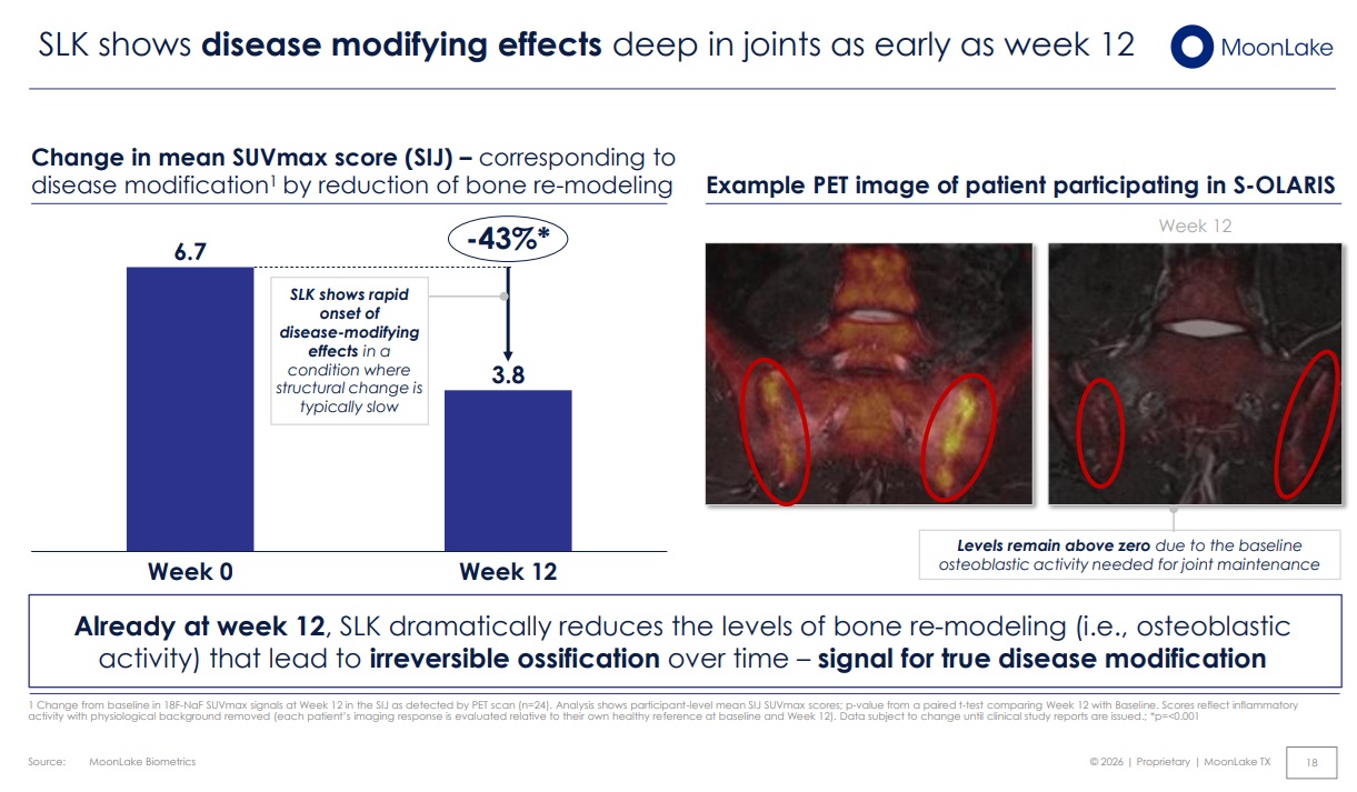 Example 18F-NaF PET/MRI from the S-OLARIS trial showing a 43% reduction in sacroiliac joint SUVmax at week 12, illustrating SLK’s deep, disease‑modifying effects on bone remodelling in axial spondyloarthritis.