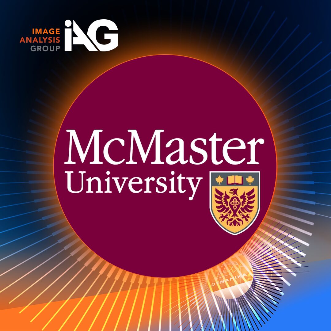 McMaster University and IAG partnership in multi‑omics and machine learning for glioblastoma research